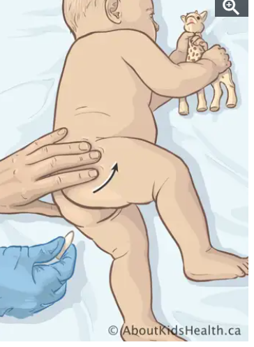 Suppository: Define in Pharmacy, Types, and Uses 5 Pediatric Suppositories